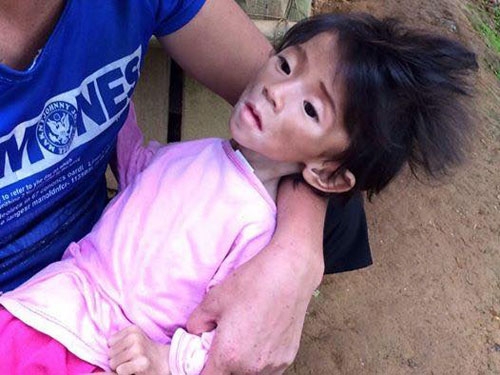 cai tet dau tien cua em be 14 thang nang 3,5kg cung me 9x hinh anh 2