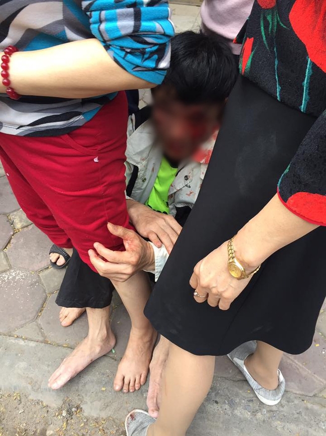 Tổ trưởng bảo vệ dân phố: Nếu không có người che chắn, tôi đã bị nhóm người nhầm là trộm xe SH đánh chết - Ảnh 2.