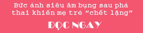 sieu am di tat, me bau 6 thang dau don pha thai, khi lay em be ra tat ca sung so - 3