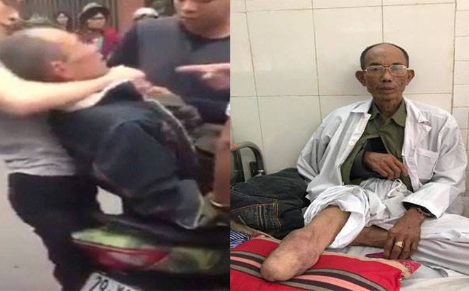 Khởi tố hai cha con hành hung thương binh do va chạm giao thông