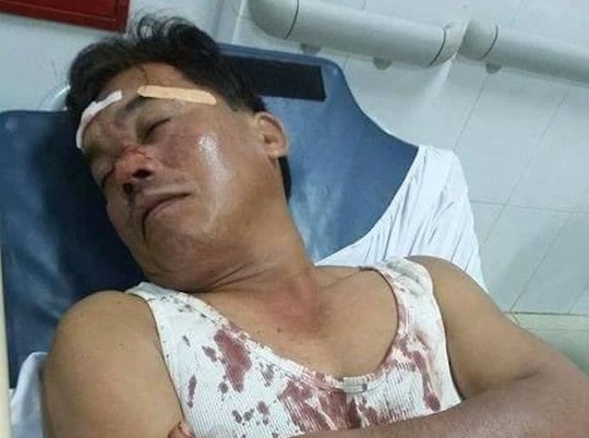 Ông Trung bị thương đang cấp cứu tại bệnh viện