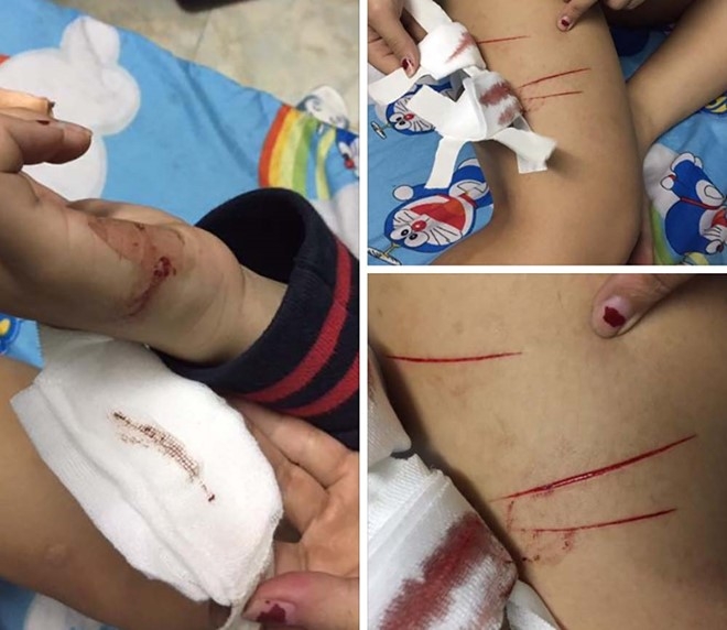 Nu sinh to bi ke bien thai rach dui trong dem hinh anh 1