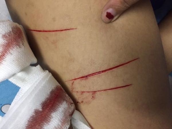 Nu sinh to bi ke bien thai rach dui trong dem hinh anh 2