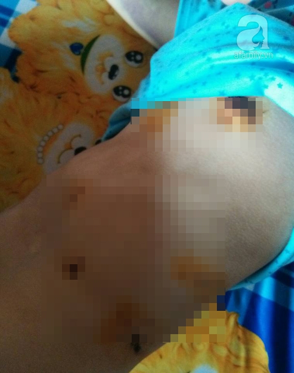 Người vợ trẻ bị bồ của chồng đánh ghen ngược: Nhìn con đòi mẹ mà bản thân bất lực không thể lại gần - Ảnh 1.