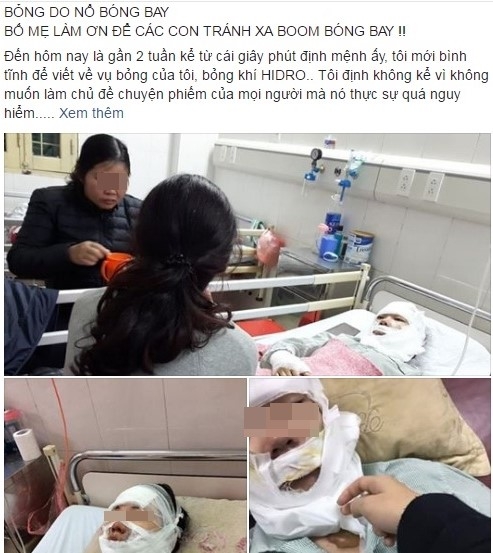 9X bi bong mat do no bong bay: Toi muon canh bao moi nguoi hinh anh 1