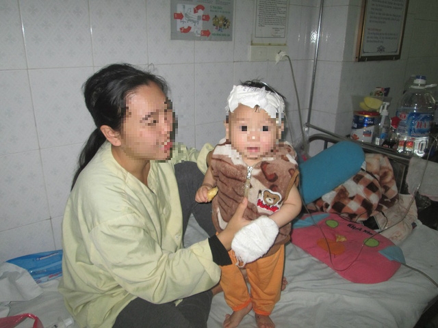  Đã hơn 1 tháng nay con trai T. điều trị tại Viện Bỏng Quốc gia. Ảnh: Ngọc Thi 