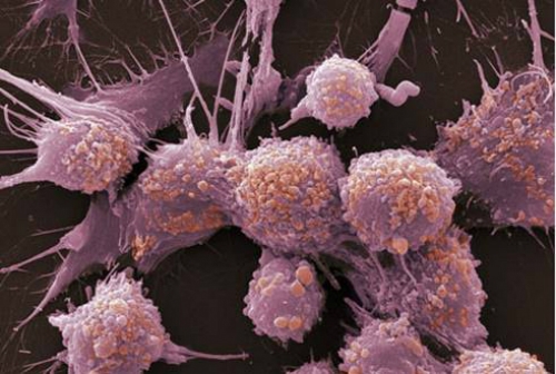 Ảnh: cancer