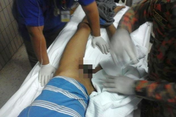 deo vong bi cho “cua quy” roi bi mac ket, bac si bo tay hinh anh 2