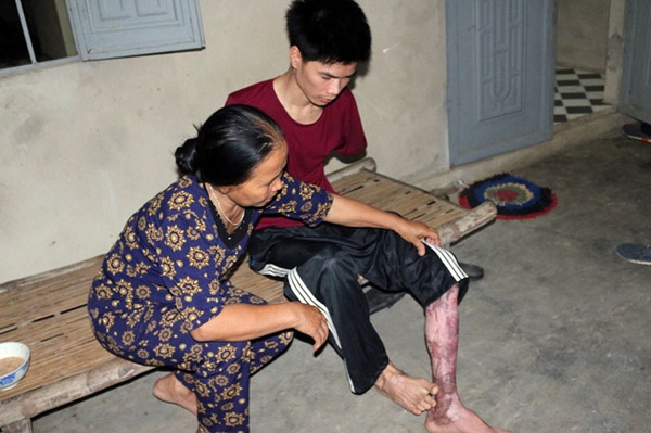  Rơi nước mắt hoàn cảnh chàng trai bị tai nạn mất tay, vợ bỏ đi, một mình chăm con thơ khát sữa - Ảnh 2.