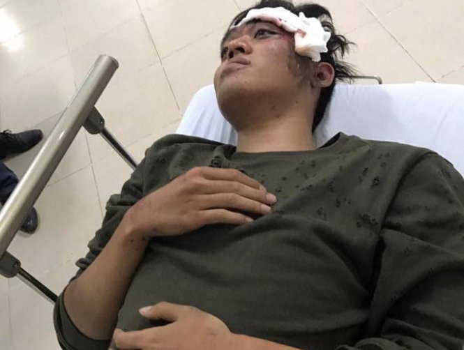 Bất tỉnh vì vướng dây điện mạng nhện 
