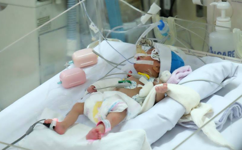 phẫu thuật tim, bệnh nhi, nhẹ cân nhất, nhỏ tuổi nhất, hẹp eo động mạch chủ, bệnh viện Nhi đồng 1