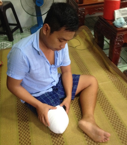 vu benh nhan bi cua chan: gia dinh de nghi khoi to bac si hinh anh 1