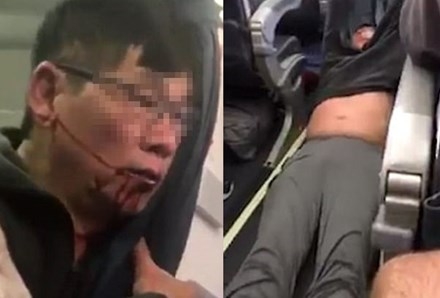 Vụ David Dao chưa dứt, United Airlines lại bị tố ép cụ bà 94 ảnh 1