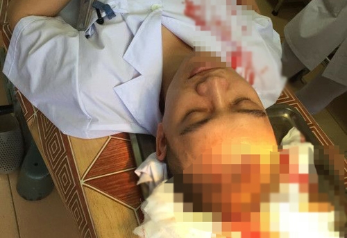 bac si bi dap coc vao dau co nguy co anh huong tri nho hinh anh 2