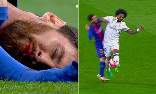messi-do-mau-gay-rang-khi-va-cham-voi-marcelo
