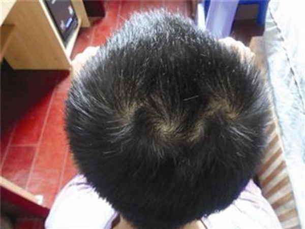 vach toc dem xoay dinh dau cua con de 