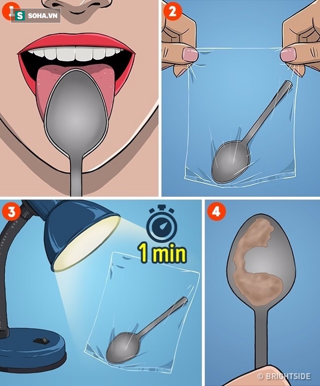 Kiểm tra sức khoẻ ngay tại nhà: Chỉ mất 1 phút và với 1 chiếc thìa - Ảnh 1.