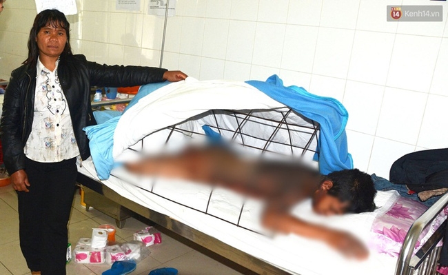 Thiếu niên 16 tuổi bị bỏng cháy đen cả người do đổ xăng trong lúc xe còn nổ máy - Ảnh 1. Thiếu niên 16 tuổi bị bỏng cháy đen cả người do đổ xăng trong lúc xe còn nổ máy - Ảnh 1.