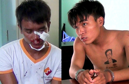 Hai kẻ cướp bị thương sau cú đạp của cô gái. Ảnh: Nguyệt Triều