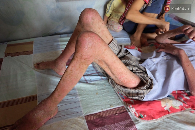 Cuộc sống khốn khó của người chồng liệt giường suốt 2 năm, từng muốn chết để vợ con bớt khổ - Ảnh 4.