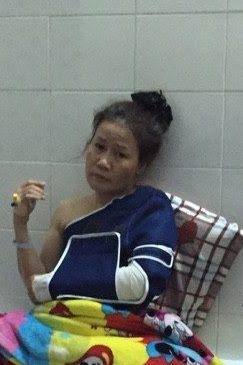Tiền Giang: Một thanh niên bị bỏng nặng do vợ ra tay sát hại