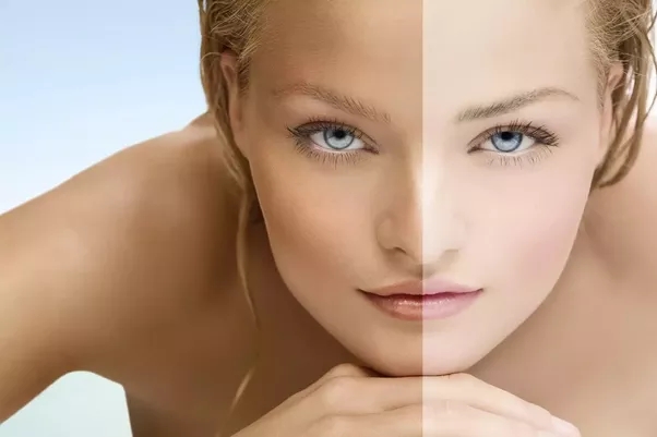 5 dấu hiệu trên mặt tố cáo bạn đang thiếu vitamin trầm trọng - Ảnh 3.