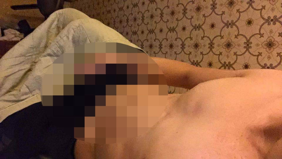 tron bo anh khoe than cua rocker nguyen bi lo chat sex? hinh anh 3