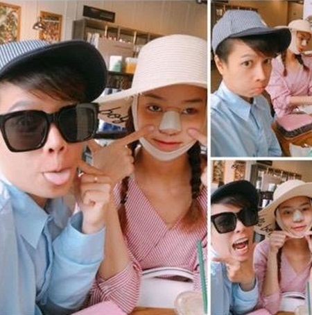 hoa hau kieu ngan bat ngo lo anh mat sung vu vi phau thuat tham my hinh anh 3
