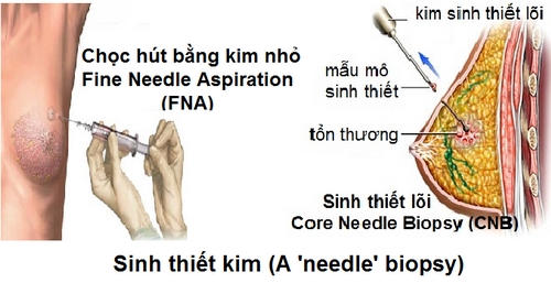 Phát hiện sớm ung thư cần làm các xét nghiệm nào? - Ảnh 1.