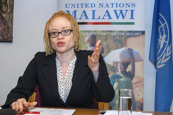 Noi so bi chat tay chan cua nguoi bach tang Malawi hinh anh 2