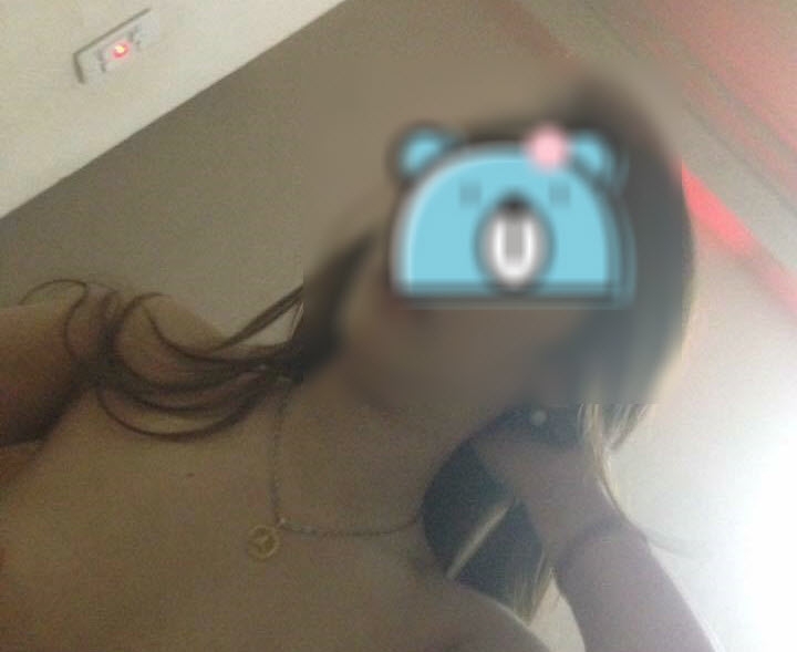 87