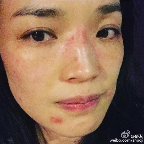bi di ung, da sung do dang so, thu ky bang bo ca mat kin mit - 3