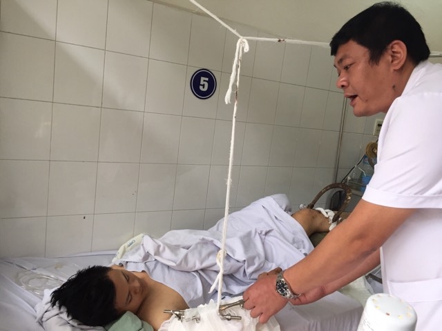 nam sinh kien truc bi cua xe khach kep dut lia canh tay tren duong ve que - 1