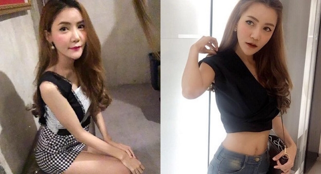 Nu y ta bi buoc thoi viec vi mac dong phuc qua goi cam hinh anh 3