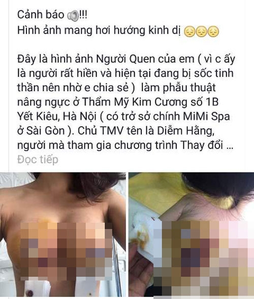 vu nhap vien sau nang nguc: giam doc benh vien tham my noi gi? hinh anh 2