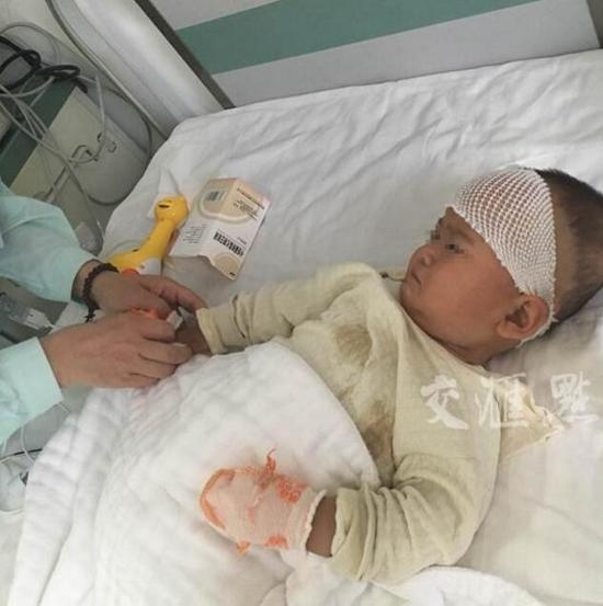 Bất mãn vì bị chồng bạo hành, mẹ cắn con 1 tuổi trọng thương - Ảnh 1.