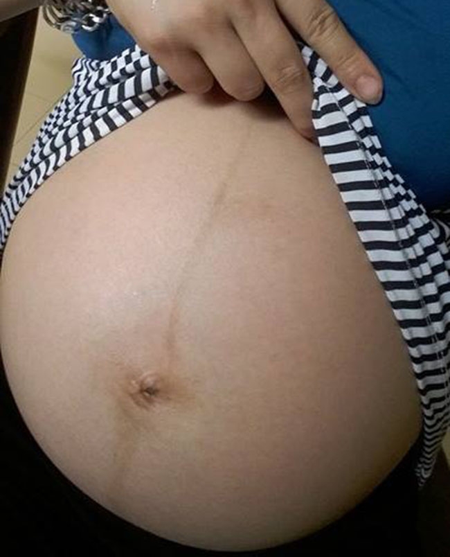 8 nam tui nhuc truoc bao loi de biu, cap vo chong bat ngo nhan cai ket ngot lim - 2