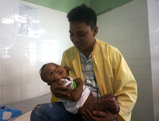 Anh Pơ loong Thơi hạnh phúc bên đứa con trai Pơloong Quốc Quân đang hồi phục kỳ diệu từng ngày /// ẢNH: AN DY