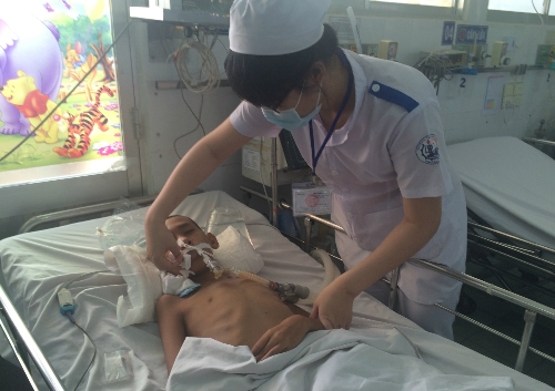 Bệnh nhi điều trị viêm não tại Khoa Nhiễm BV Nhi đồng 1 (TP HCM). Ảnh: Lê Phương.