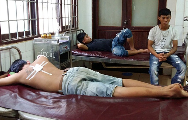 dak lak: cong an xa dung dan cao su ban 3 nguoi bi thuong hinh anh 1