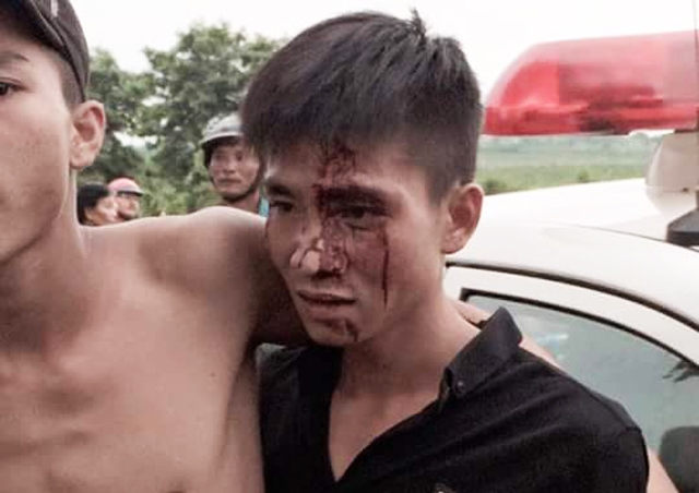 xac minh thong tin csgt vo co danh nguoi hinh anh 1