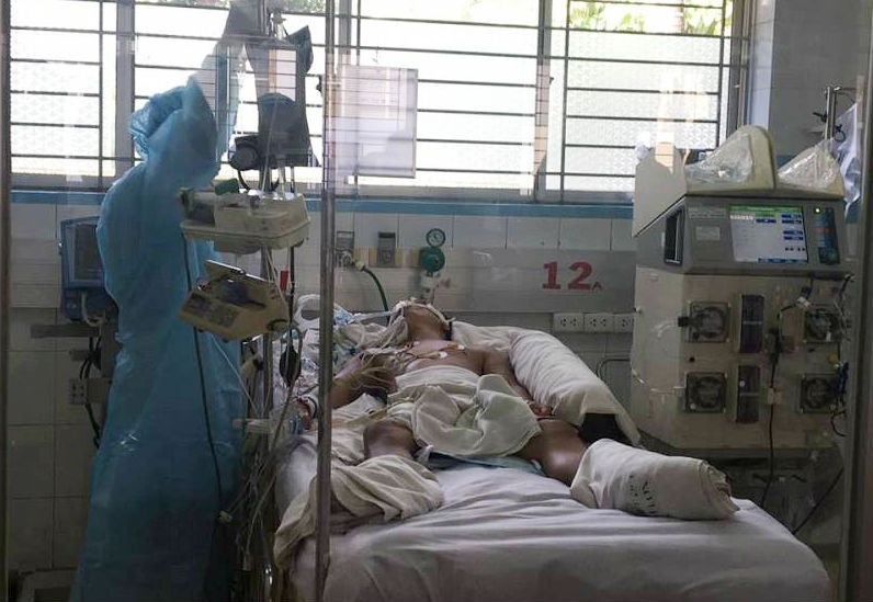 bệnh dại, chó dại, chó nhà cào xước, suy hô hấp, Gia Lai