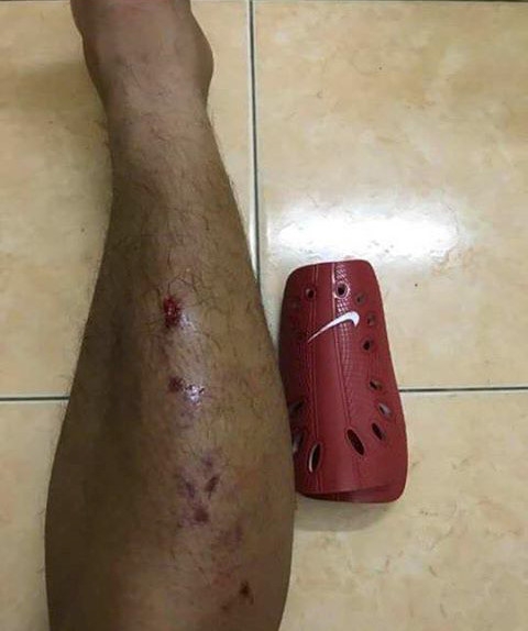 NHM phan no, doi cam vinh vien Sam Ngoc Duc sau pha triet ha doi thu hinh anh 2