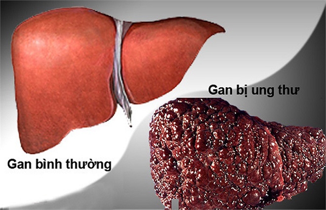 Danh y chia sẻ cách rửa sạch nội tạng: Không chỉ tôi, tất cả chúng ta đều nên làm ngay! - Ảnh 8.