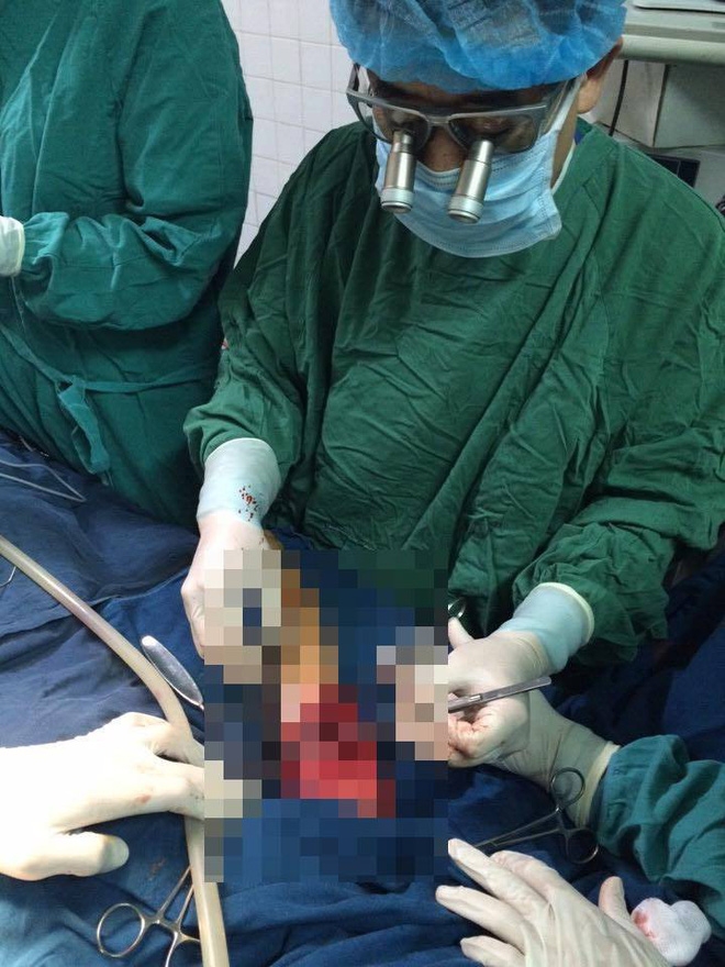 Hà Nội: Cứu sống và phẫu thuật cứu cánh tay phải của bé gái 5 tuổi sau vụ TNGT - Ảnh 1.