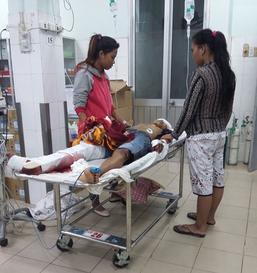  Một nam thanh niên bị truy sát, chém gần đứt lìa chân - ảnh 1