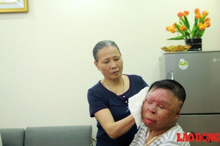 Chiến sĩ sống sót vụ rơi trực thăng muốn có tay giả để không bị gọi “người ngoài hành tinh“ ảnh 1