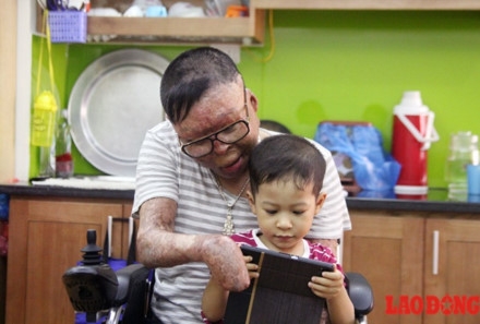 Chiến sĩ sống sót vụ rơi trực thăng muốn có tay giả để không bị gọi “người ngoài hành tinh“ ảnh 2