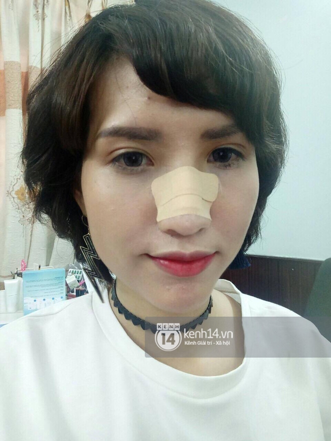 Nghi vấn Nguyễn Hợp - Hồng Xuân tát nhau gãy mũi tại Next Top Model - Ảnh 3.
