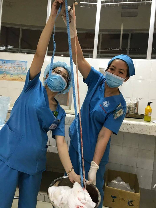 Bé gái Sài Gòn chào đời khoẻ mạnh với “4 sợi dây chuyền” ở cổ - Ảnh 1.